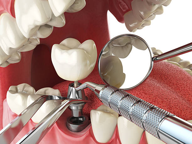 Best Emergency Denture Repair in Donalsonville, GA